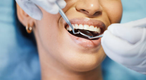 Best Emergency Dental Filling Replacement  in Aptos, CA