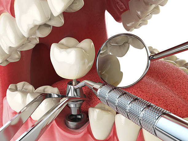 Best Tooth Pain Emergency Relief  in Aptos, CA