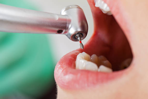 Best Emergency Dentist for Kids  in Aptos, CA